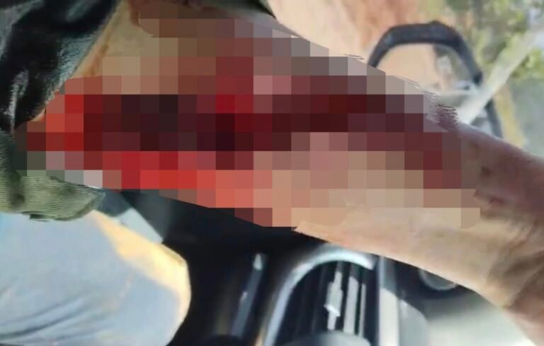 Polisi Periksa Saksi Kasus Pembacokan Karyawan PT Toshida